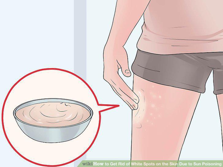 Step 8