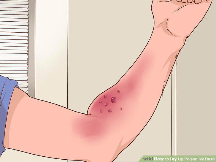 Step 12
