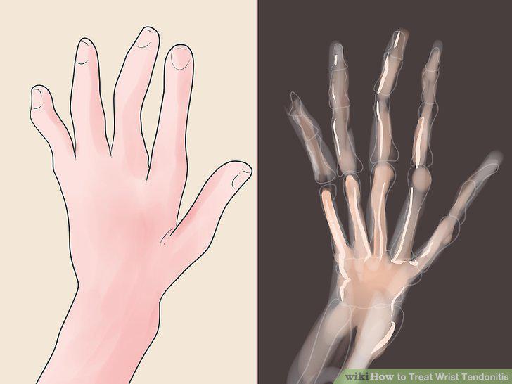 Step 13