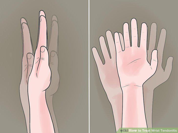 Step 14
