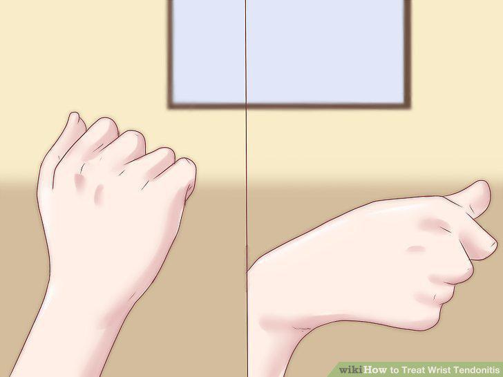 Step 15