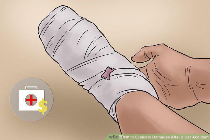Step 14