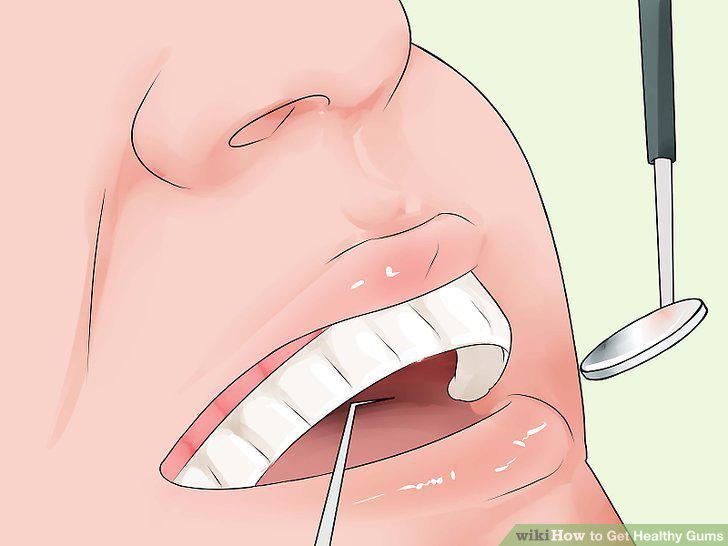 Step 6