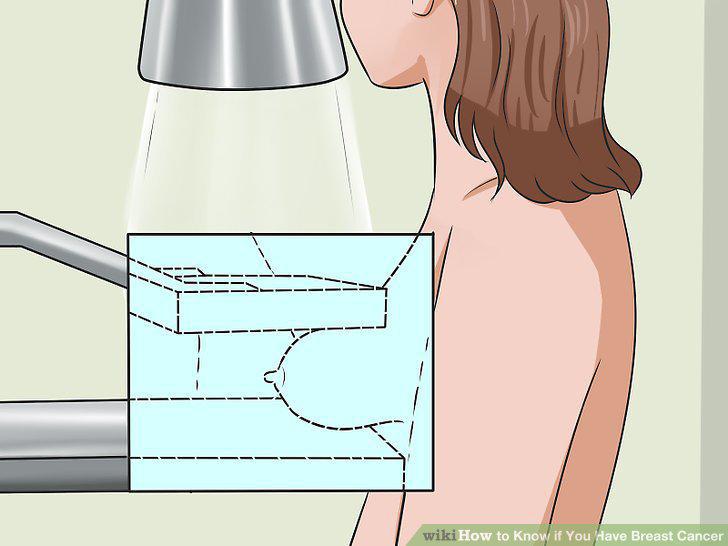 Step 15