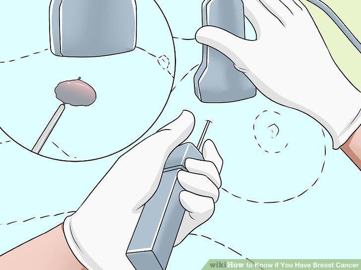 Step 17