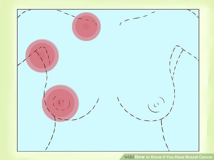 Step 9