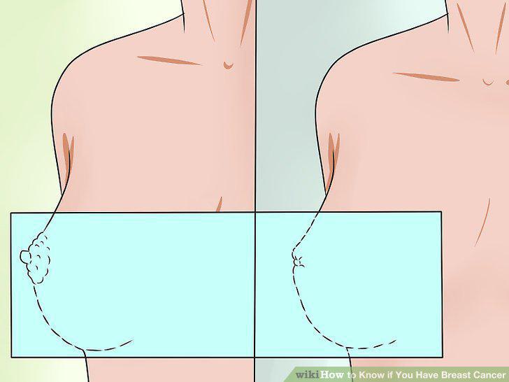 Step 10