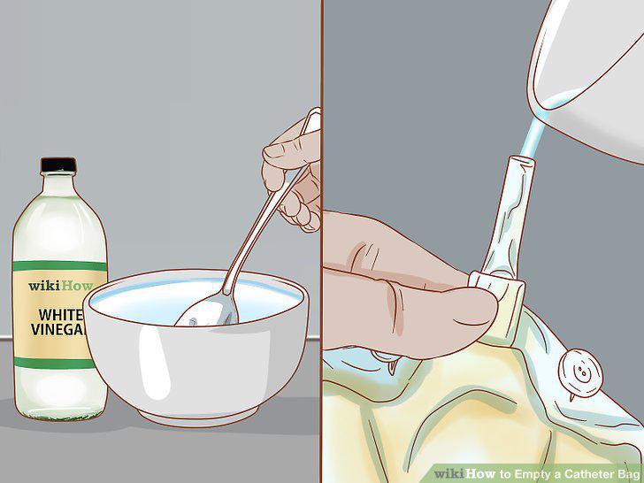 Step 12