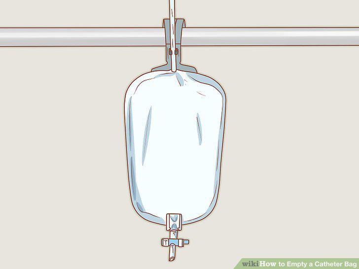 Step 14