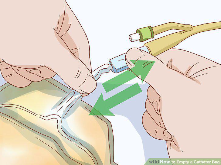 Step 10
