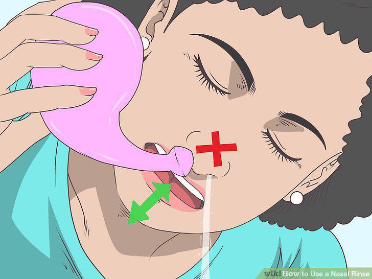 Step 8