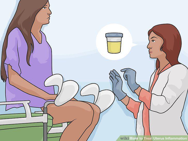 Step 10