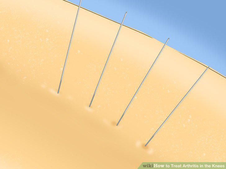 Step 11
