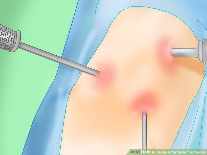 Step 12
