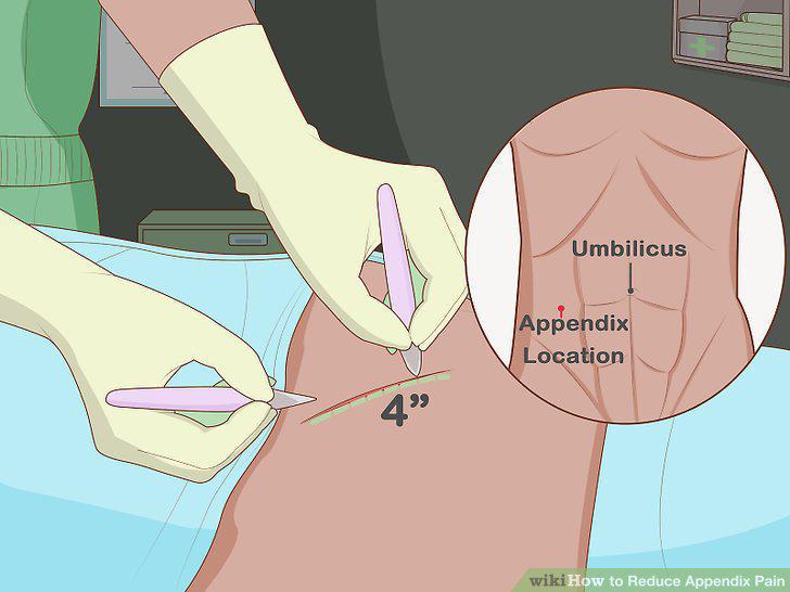 Step 11