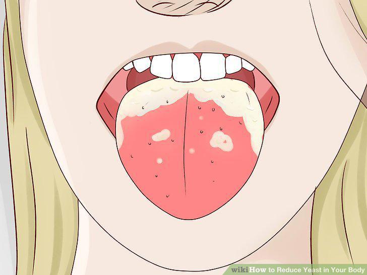 Step 23