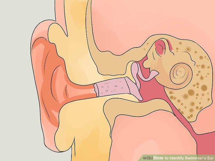 Step 11