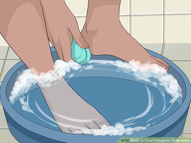 Step 2