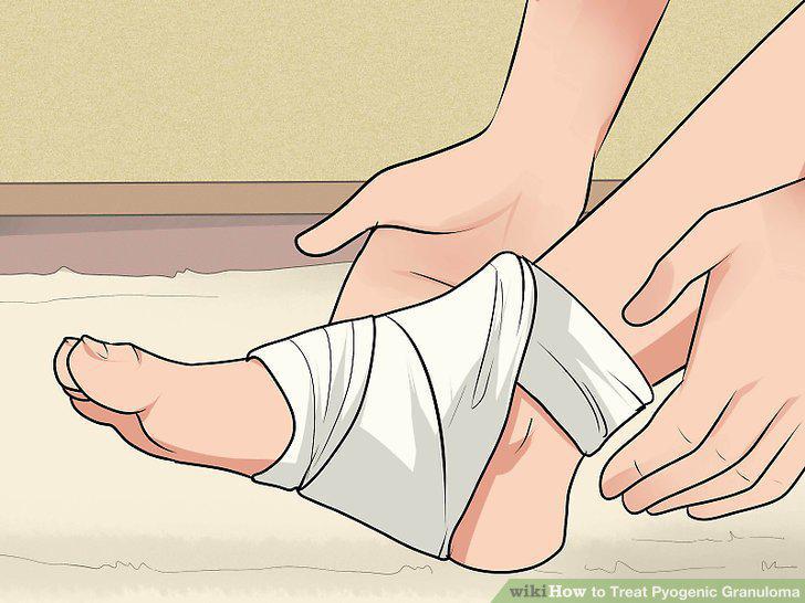 Step 11