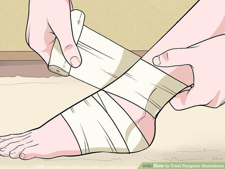 Step 12