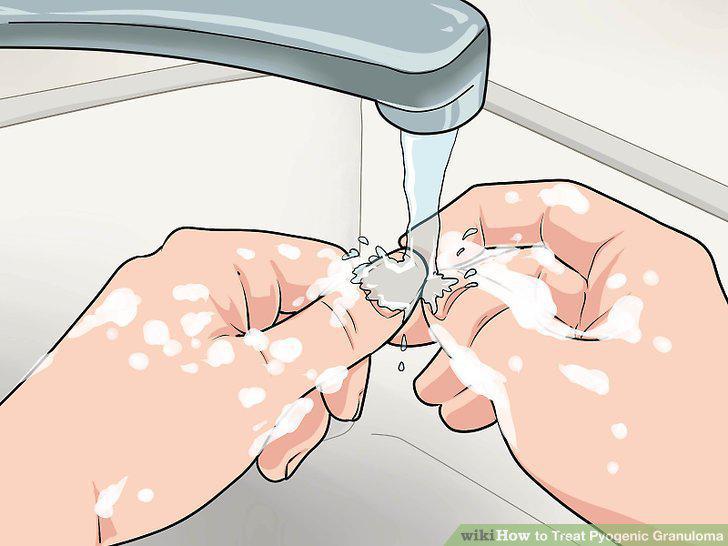 Step 13