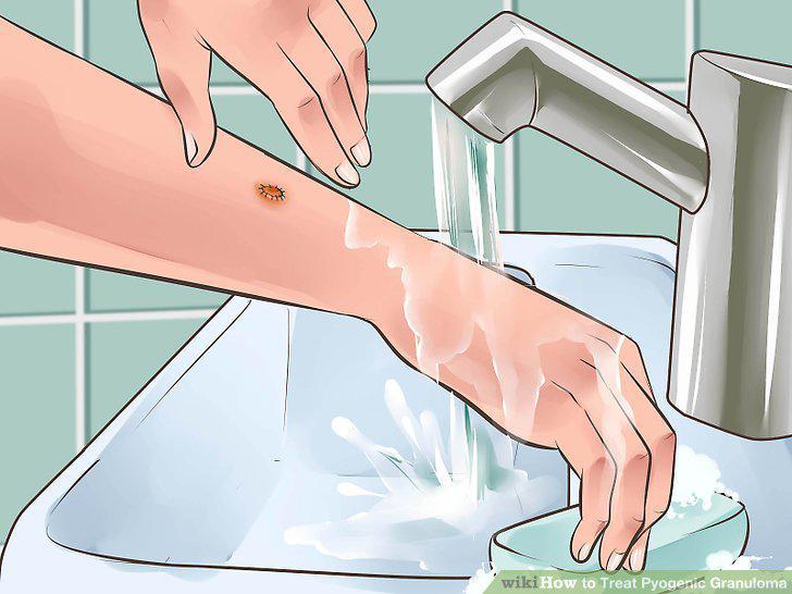 Step 14