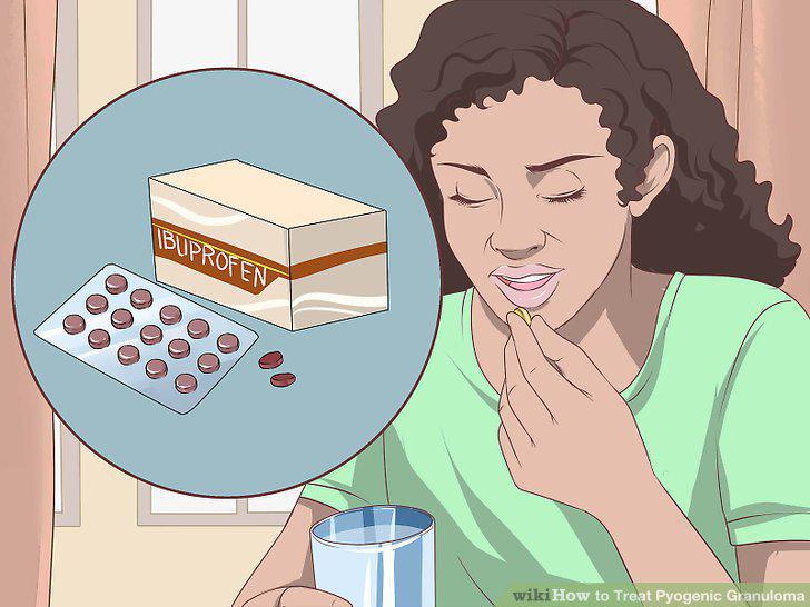 Step 15