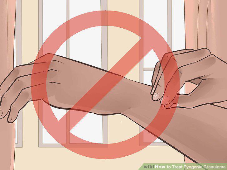 Step 5