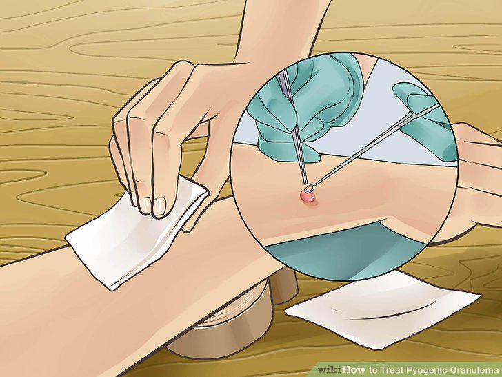 Step 7