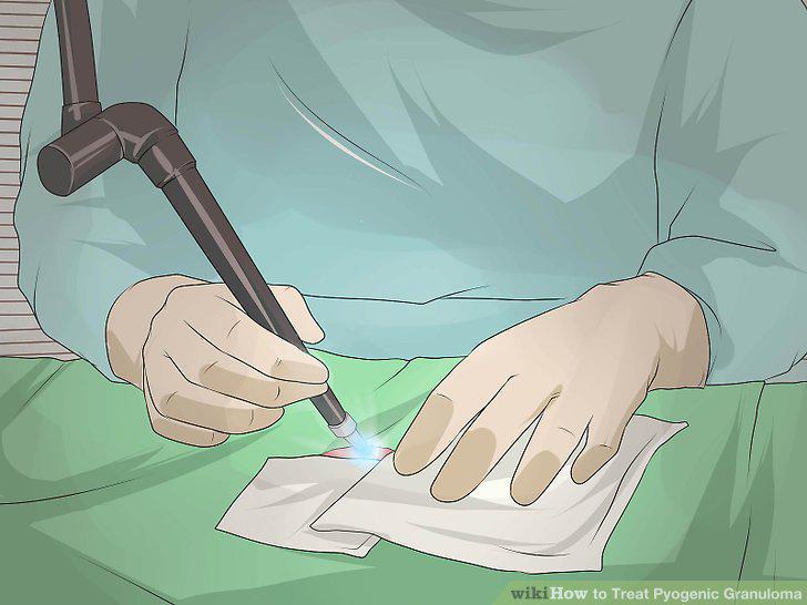 Step 10