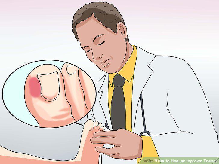 Step 11