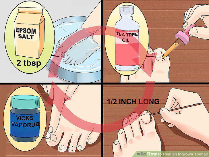 Step 5