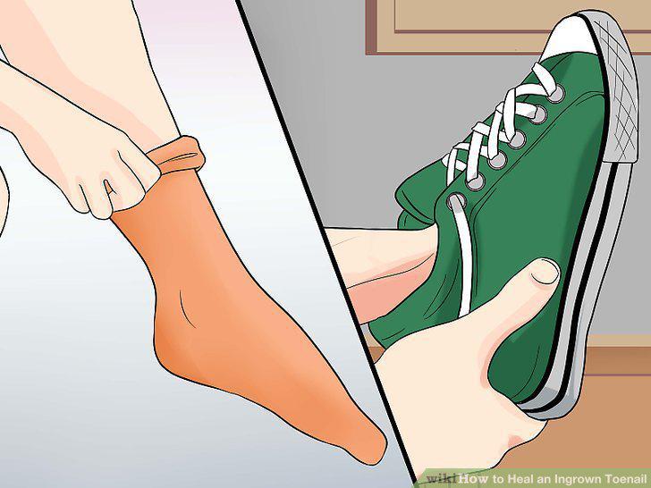 Step 6