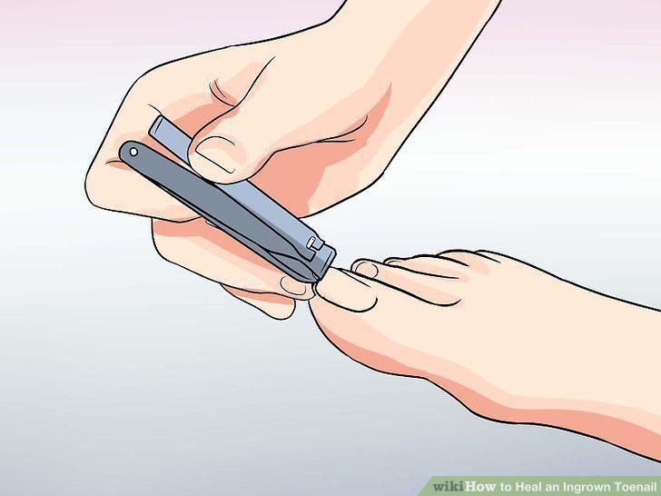 Step 7