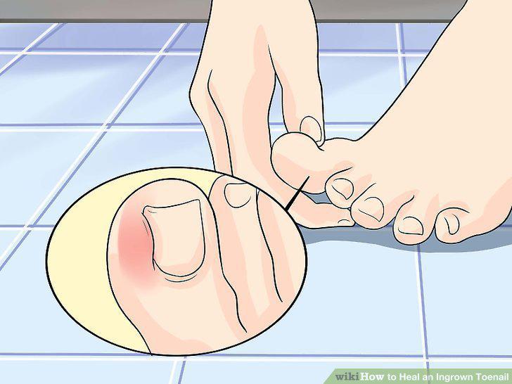 Step 10