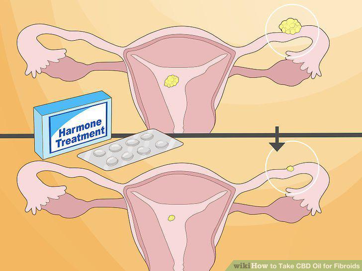 Step 13