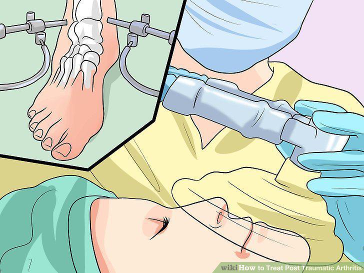 Step 11