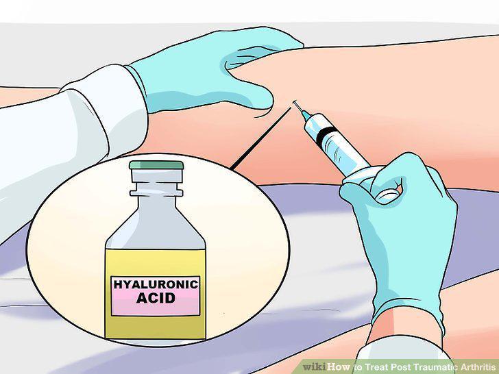 Step 9
