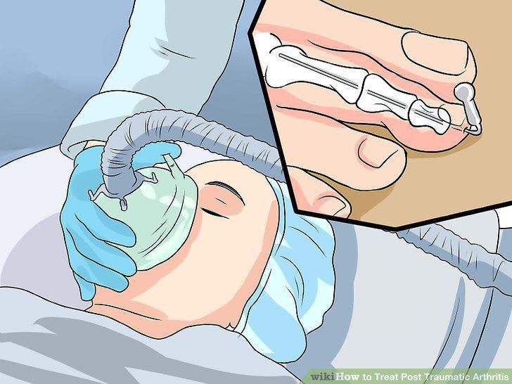 Step 10