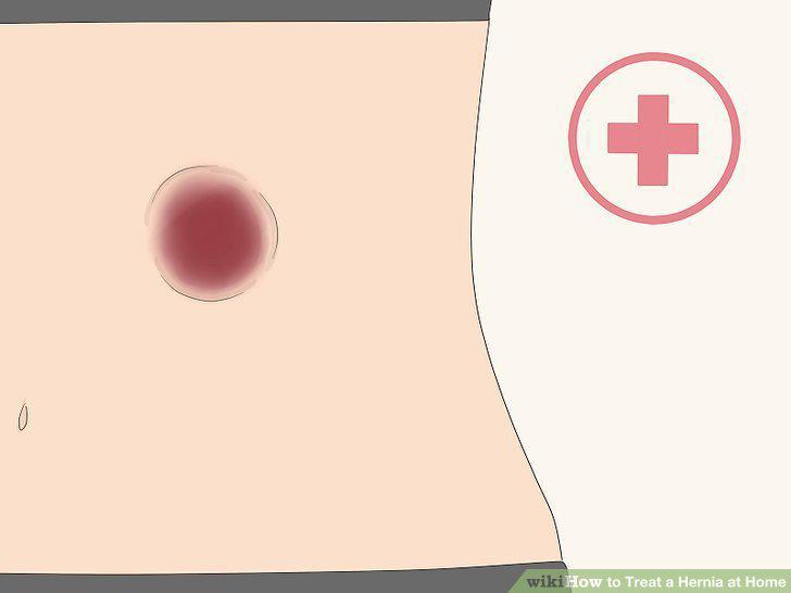 Step 13