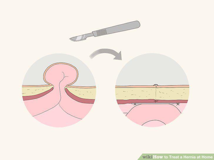 Step 15