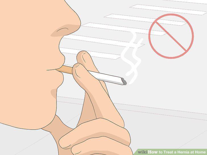Step 9