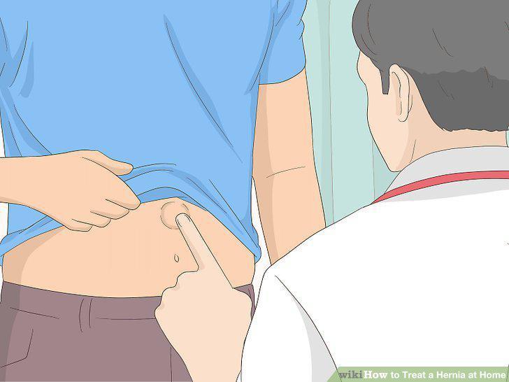 Step 10