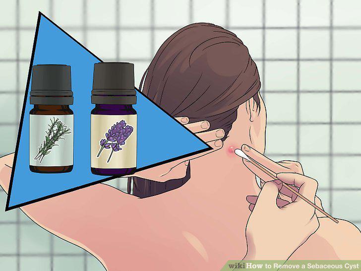 Step 5