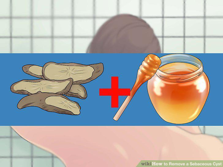 Step 8