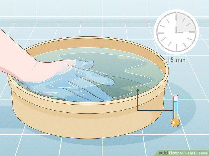 Step 2