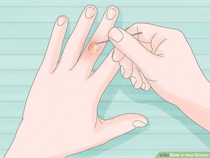 Step 13
