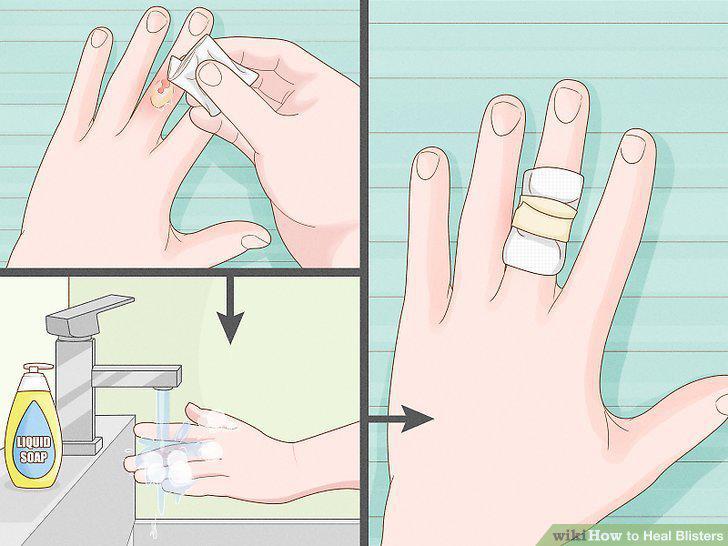 Step 14