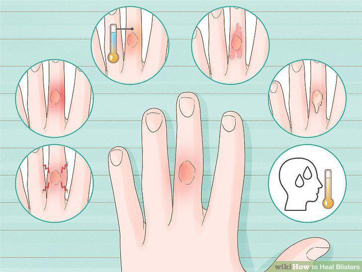 Step 16