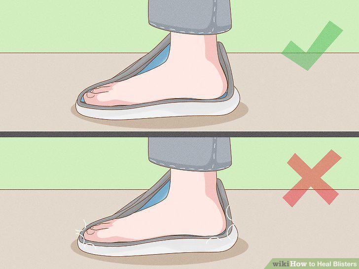 Step 18
